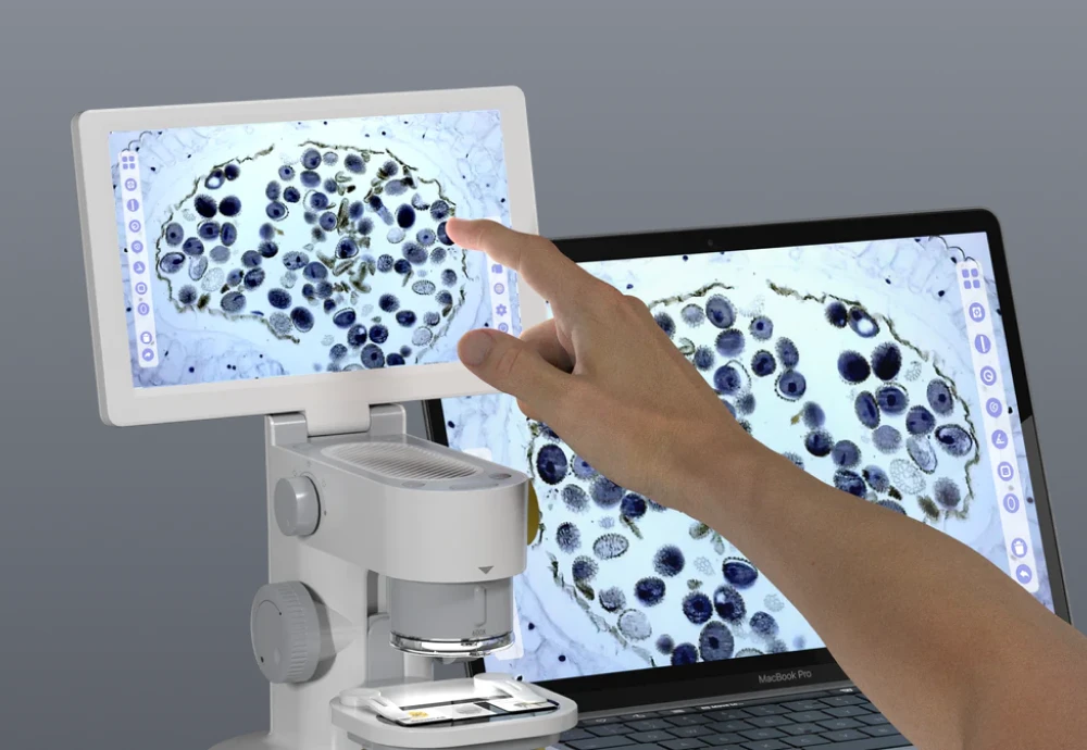 computer microscope